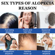 PEGCIZ Scalp Serum for Hair Growth, 30ml