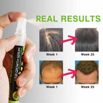 SEFUDUN Peppermint Hair Growth Serum, 10ml
