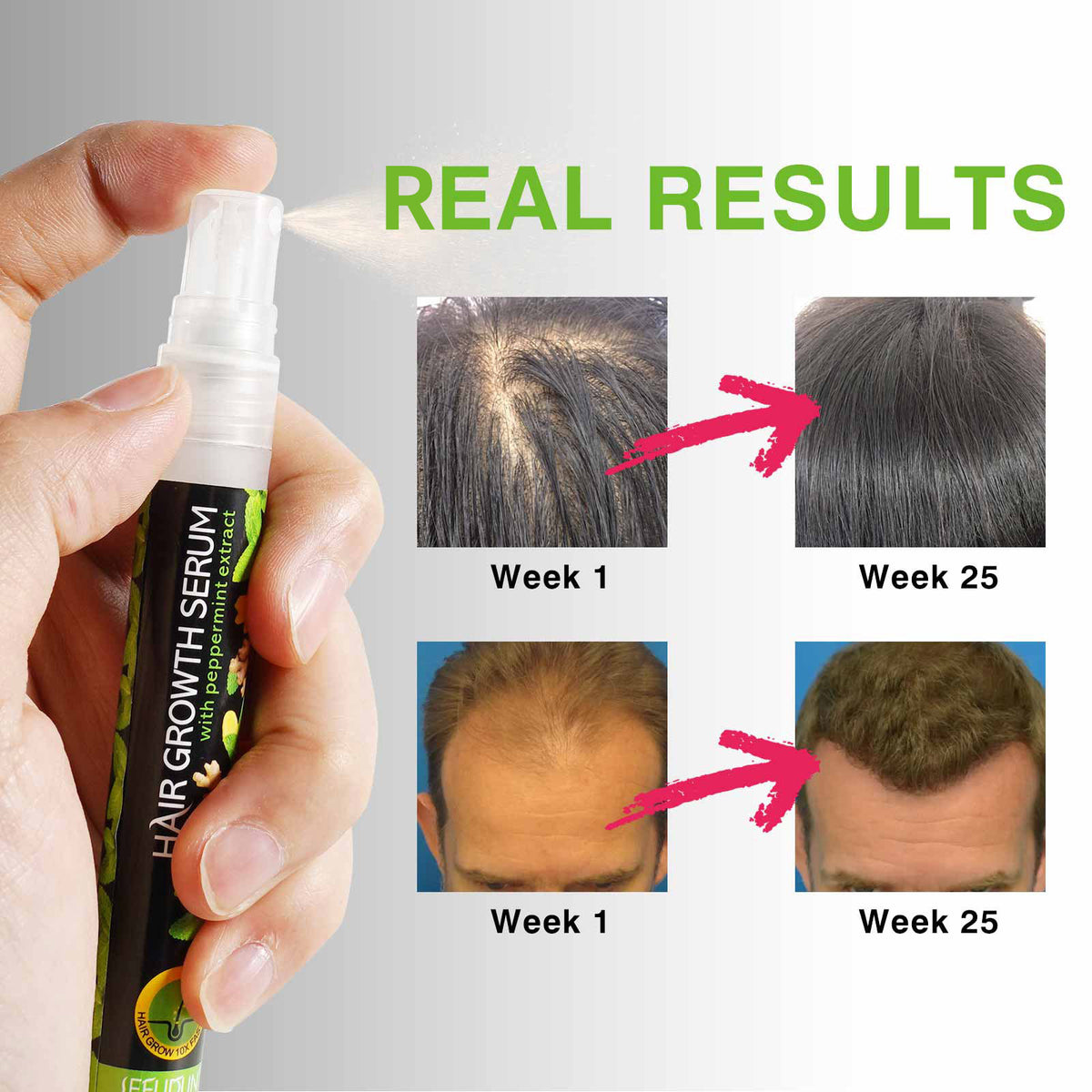 SEFUDUN Peppermint Hair Growth Serum, 10ml