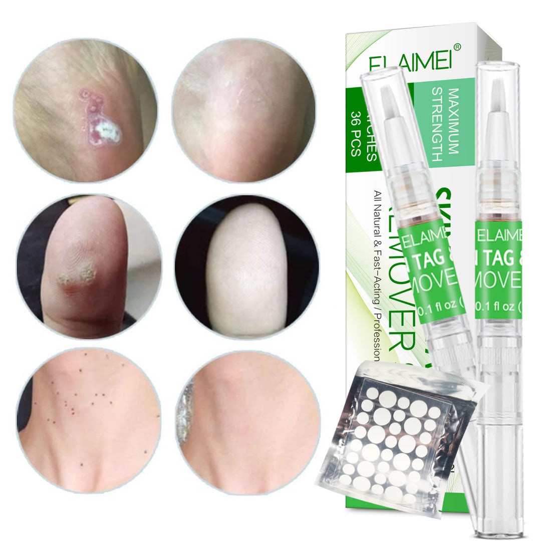 ELAIMEI 2n1 Skin Tag Remover Pens & Anti Acne Patches Set