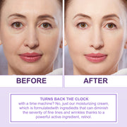 Elbbub 2.5% Retinol Face Cream