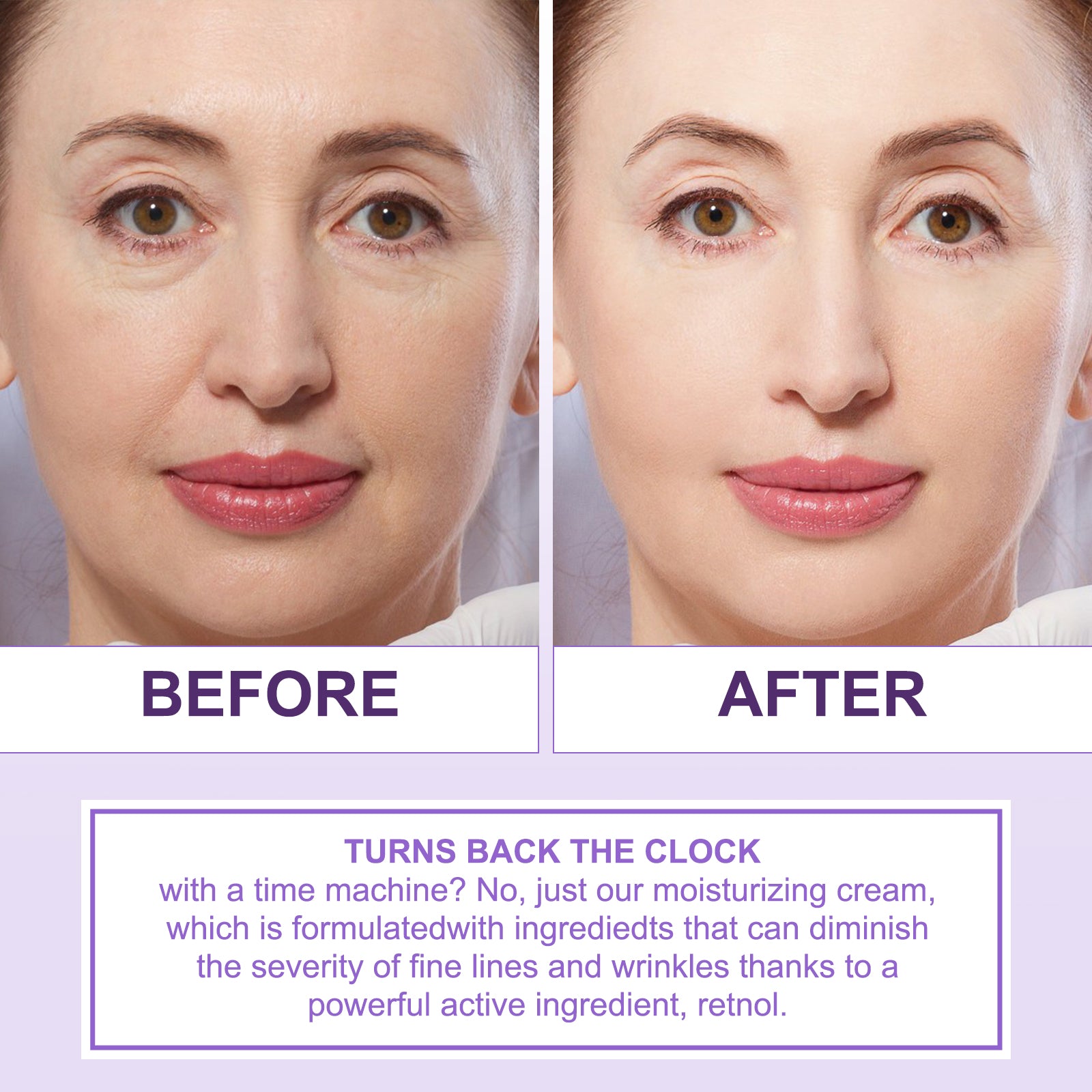 Elbbub 2.5% Retinol Face Cream