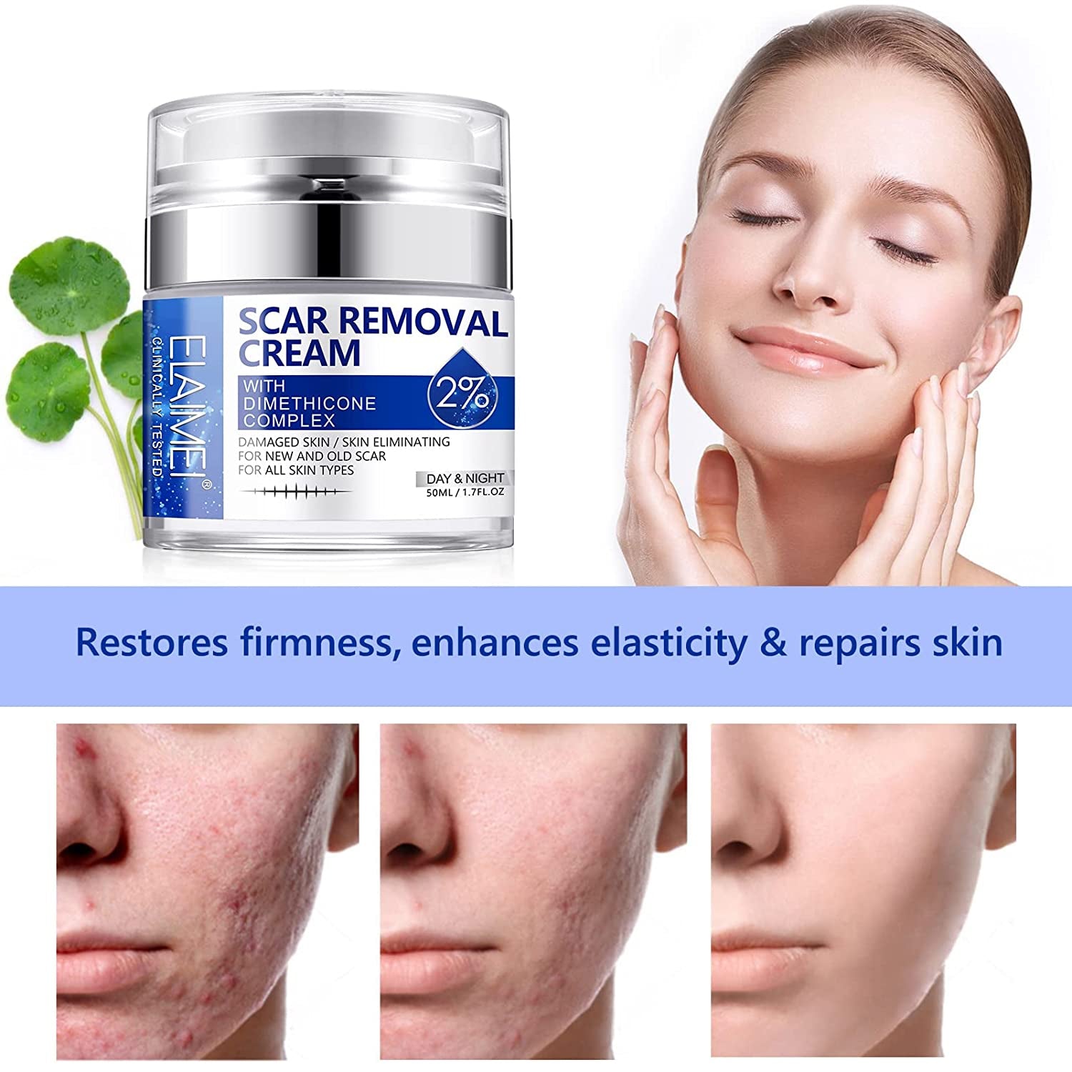 ELAIMEI Advanced Scar Removal Cream, Day & Night 50ml