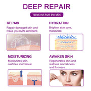 Elaimei Silicone Scar Removal Gel Tape Roll for Skin Treatment Repair 1.5 m