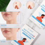 ELAIMEI Patches for Skin Tag & Acne Removal, 144pcs