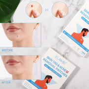 ELAIMEI Patches for Skin Tag & Acne Removal, 144pcs