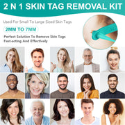 ALIVER 2in1 Skin Tag Remover Kit