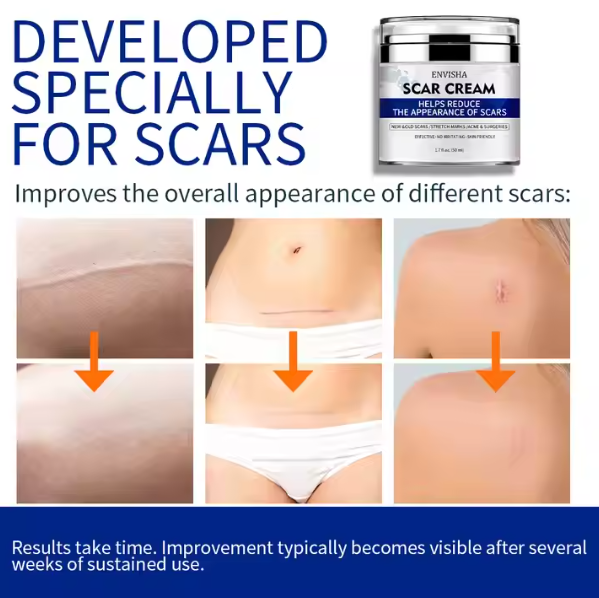 ENVISHA Scar Removal Cream, 50ml