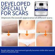 ENVISHA Scar Removal Cream, 50ml