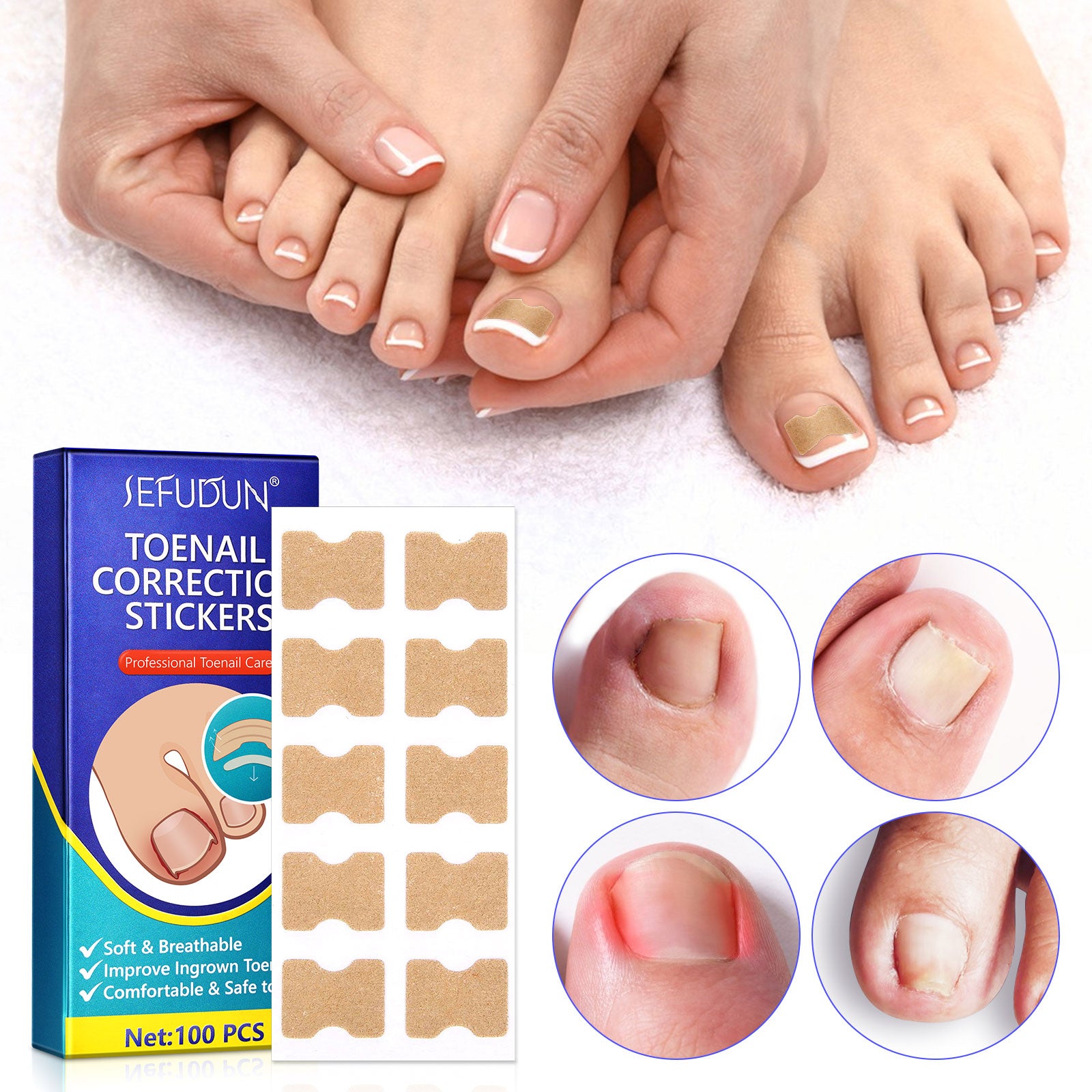 SEFUDUN Toenail Correction Stickers, pack of 100pcs