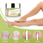 ELAIMEI Anti Varicose Veins Cream for Legs, 50g