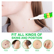 ALIVER Body Skin Tag Remover Pens, Anti Mole & Wart Kit, 5pcs
