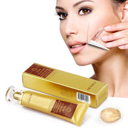 ALIVER Removal Gel Ointment for Scar & Acne Marks, 30ml