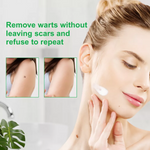 ALIVER Skin Tag, Acne & Wart Remover Cream, 100g