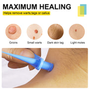 ELAIMEI 2in1 Fast & Effective Skin Tag Remover Kit