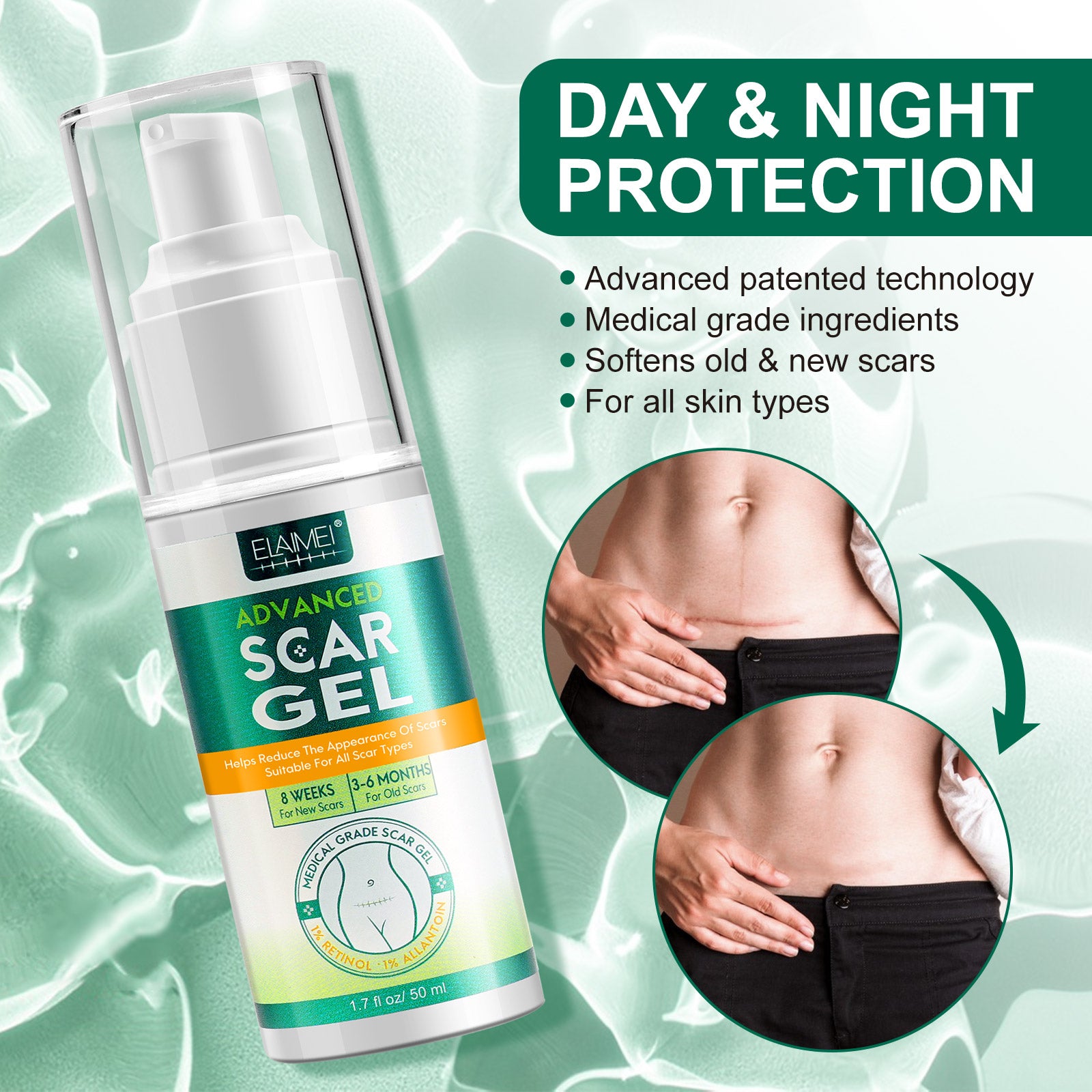 ELAIMEI Advanced Scar Removal Gel for Body, 50ml