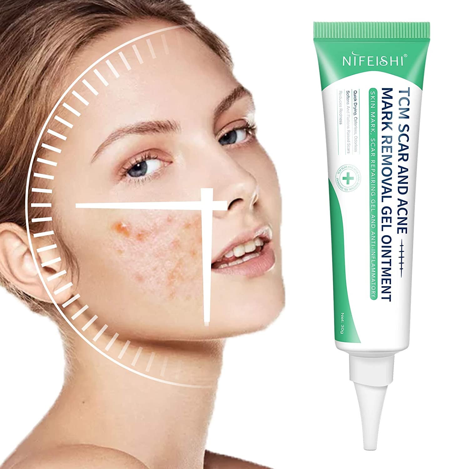 Nifeishi  Advanced Scar Removal Gel Cream Treatment Repair Acne Marks Ointment Skin Care