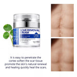 ELAIMEI Advanced Scar Removal Cream, Day & Night 50ml