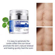 ELAIMEI Advanced Scar Removal Cream, Day & Night 50ml