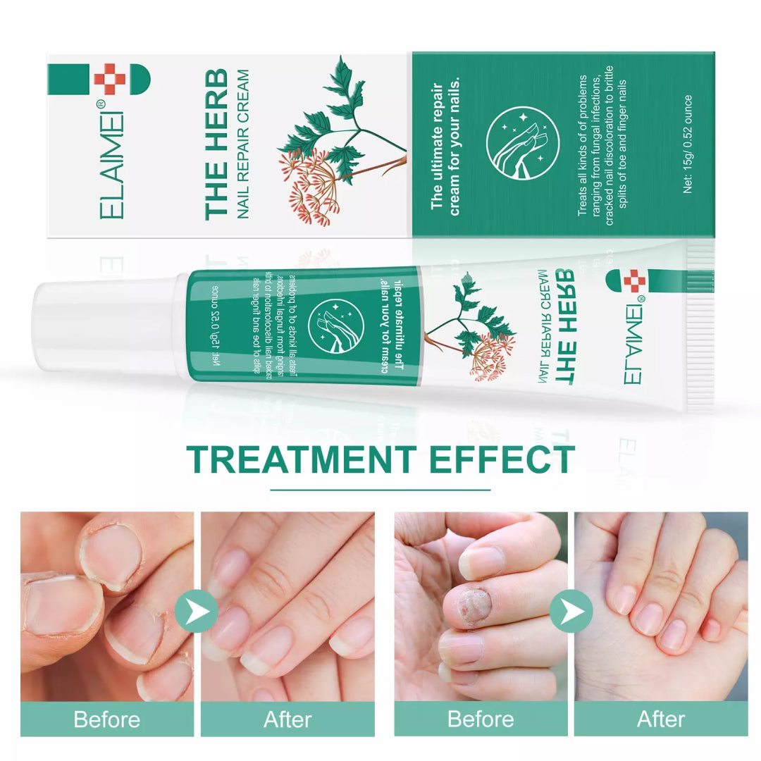 ELAIMEI Herbal Nail Repair Cream, 15g