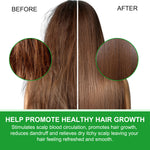 ALIVER Natural Monarda Essential Oil for Hair Growth, 60ml