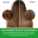 ALIVER Natural Monarda Essential Oil for Hair Growth, 60ml
