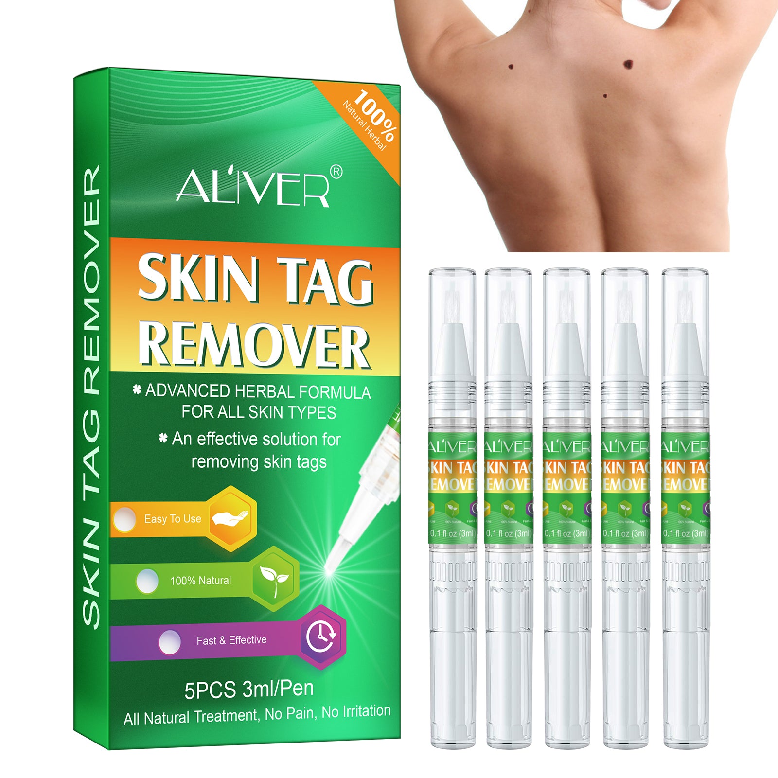 ALIVER Body Skin Tag Remover Pens, Anti Mole & Wart Kit, 5pcs