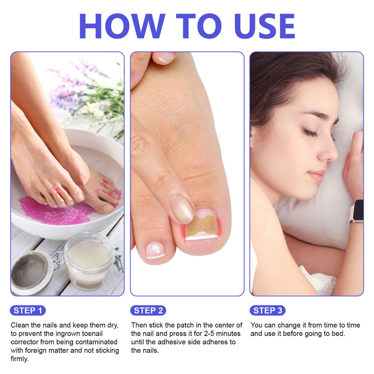 SEFUDUN Toenail Correction Stickers, pack of 100pcs