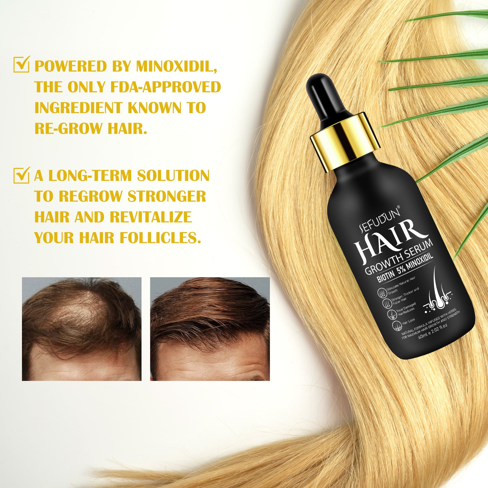 SEFUDUN Hair Growth Serum + Derma Roller Kit