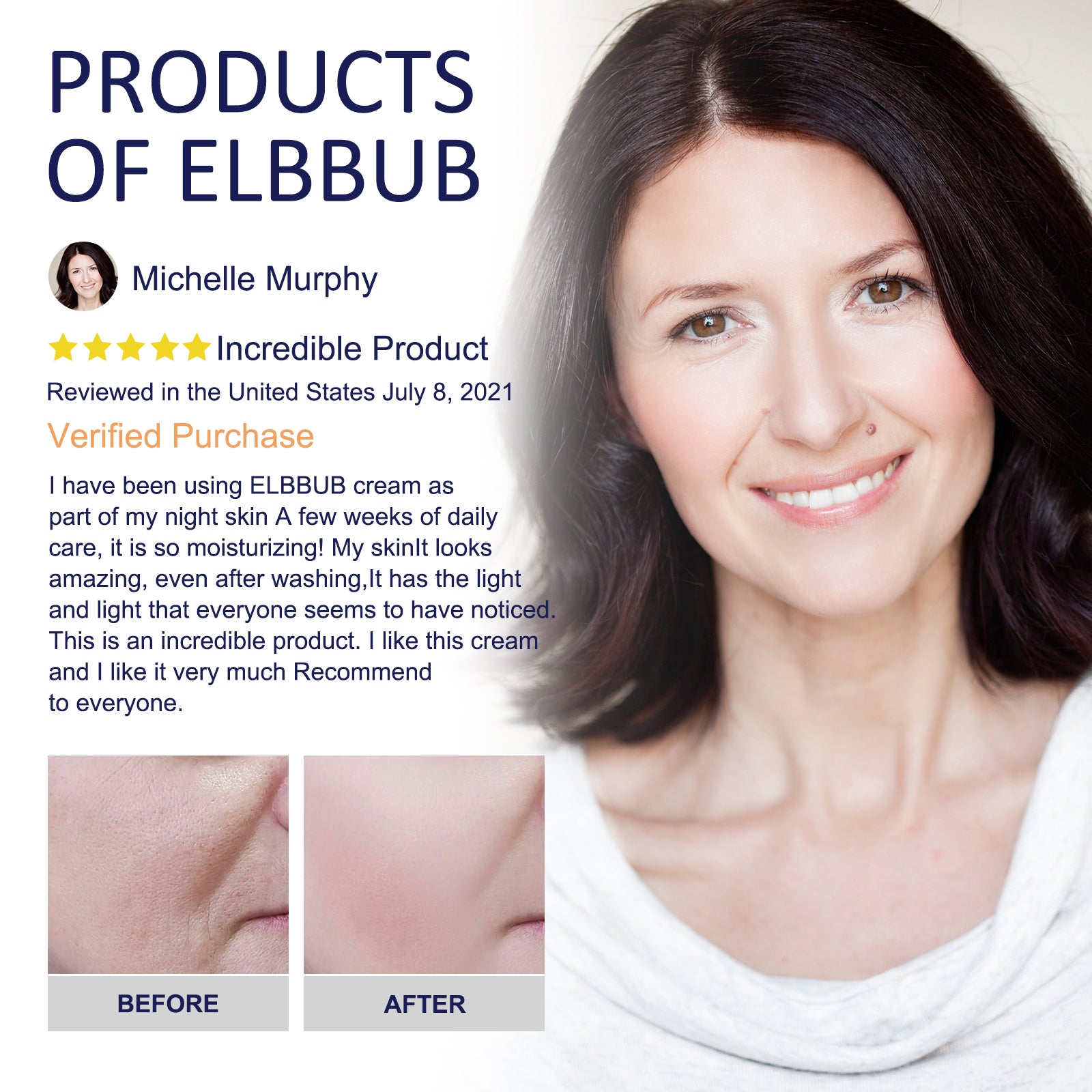 ELBBUB Advanced 2.5% Hyaluronic Acid Cream, 50ml