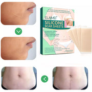 Elaimei Silicone Sheets for Scar Removal