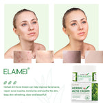 ELAIMEI Herbal Acne Treatment Cream, 50g