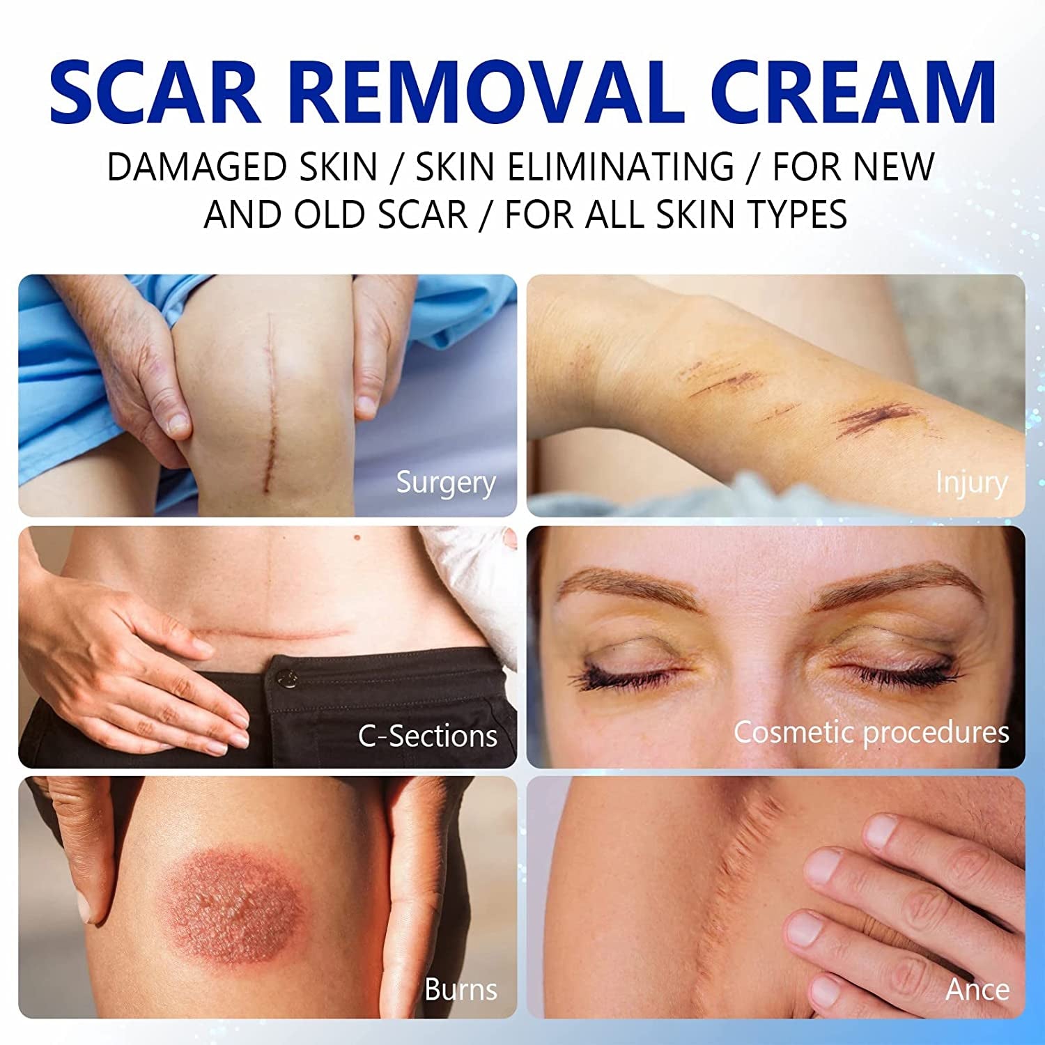 ELAIMEI Advanced Scar Removal Cream, Day & Night 50ml