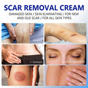 ELAIMEI Advanced Scar Removal Cream, Day & Night 50ml