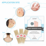 ELAIMEI Corn Wart Removal Foot Pads, 24pcs