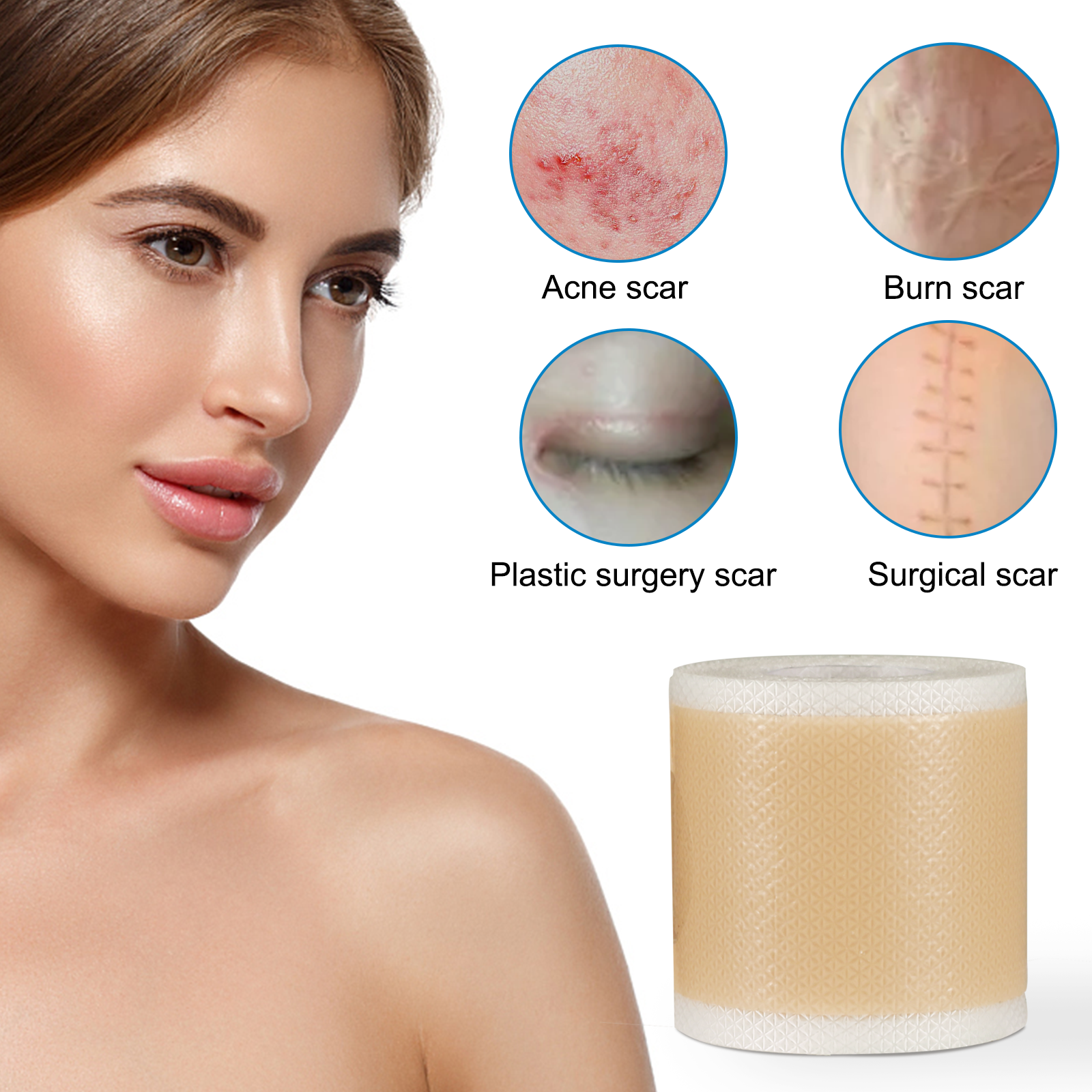 VALLEYLUX Silicone Scar Tape, 1.5m