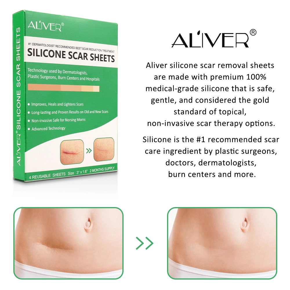 ALIVER Silicone Scar Sheets, Reduction Treatment, pack of 4pcs