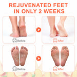 ALIVER Peach Soft Foot Peel Mask, 3in1 Kit