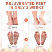 ALIVER Peach Soft Foot Peel Mask, 3in1 Kit