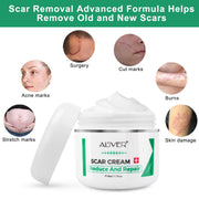 Aliver Treatment Scar Remove Cream for Body Face Skin