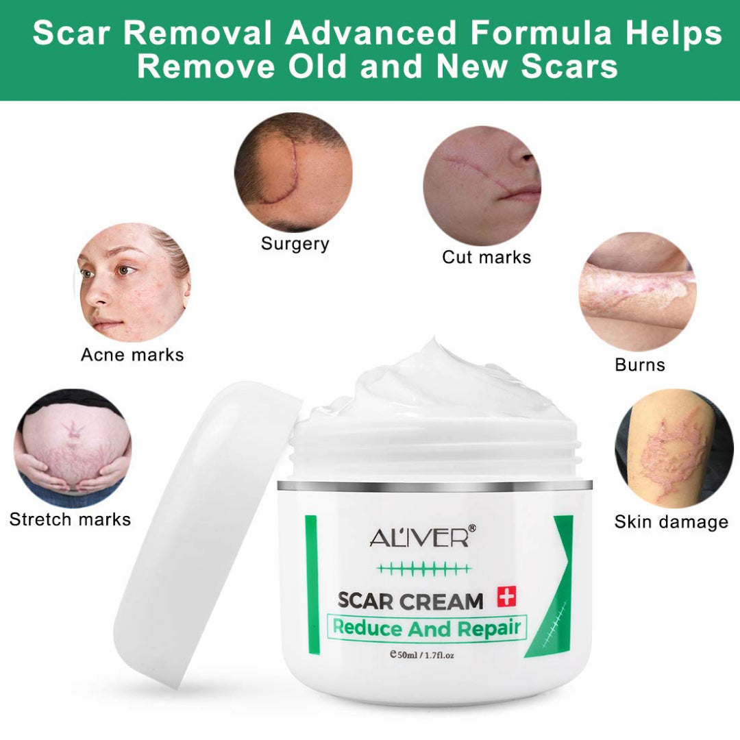 Aliver Treatment Scar Remove Cream for Body Face Skin