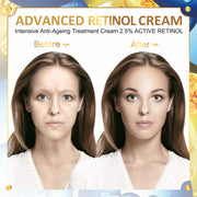 IFUDOIT Advanced 2.5% Retinol Face Cream, 50ml