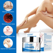 VOGSIG Varicose Veins Cream, 50g