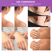 ELAIMEI Silicone Scar Gel Sheets Skin Treatment