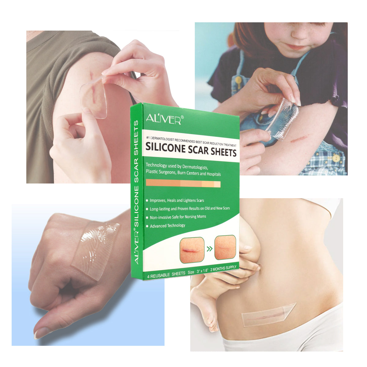 ALIVER Silicone Scar Sheets, Reduction Treatment, pack of 4pcs