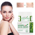 ELAIMEI Herbal Acne Treatment Cream, 50g