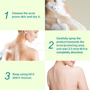 ELAIMEI Natural Body Back Acne Treatment, 120ml