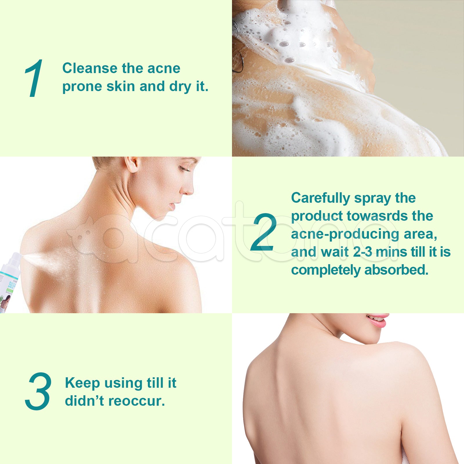 ELAIMEI Natural Body Back Acne Treatment, 120ml