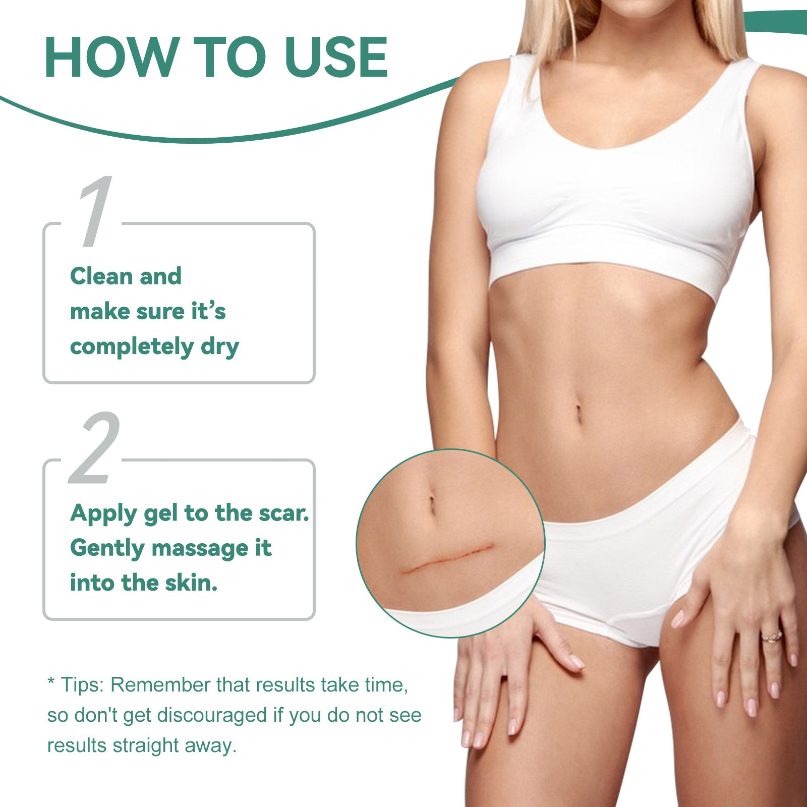 ELAIMEI Advanced Scar Removal Gel for Body, 50ml