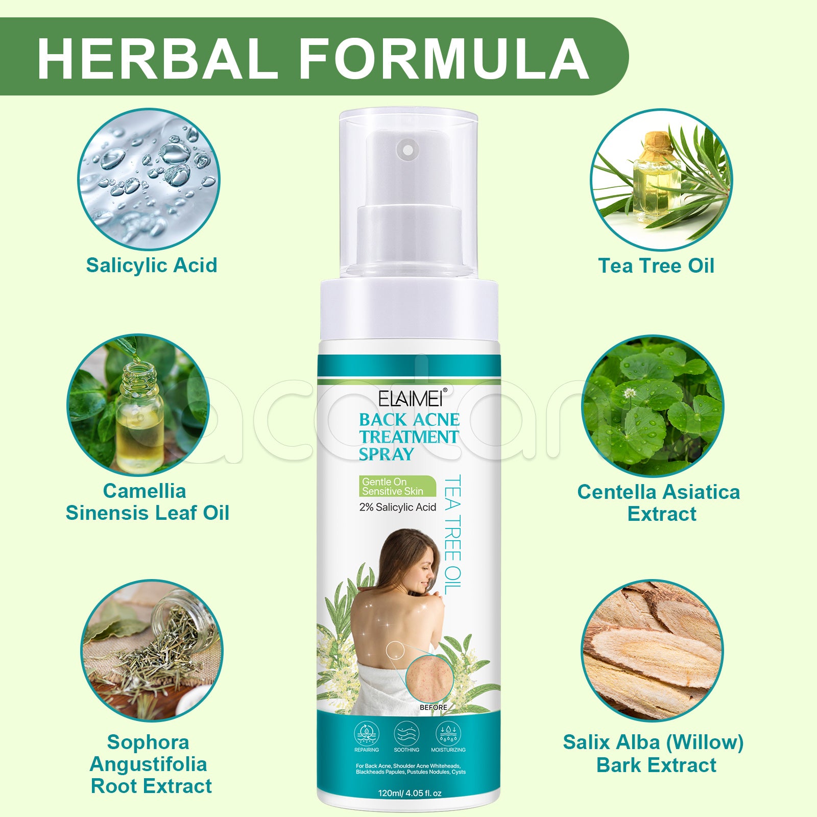 ELAIMEI Natural Body Back Acne Treatment, 120ml